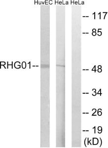 Western blot analysis of lysates from HeLa and HUVEC cells using Anti-RHG1 Antibody The right hand lane represents a negative control, where the antibody is blocked by the immunising peptide