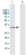 Anti-CRHBP Rabbit Polyclonal Antibody