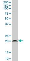 Anti-RPL21 Mouse Polyclonal Antibody