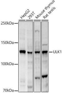 Western blot analysis of extracts of various lysates, using Anti-ULK1 Antibody (A10448) at 1:2000 dilution