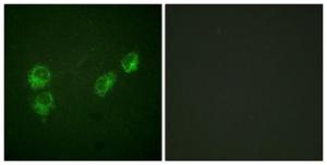 Immunofluorescence analysis of HUVEC cells using Anti-PLB (phospho Ser16+Thr17) Antibody. The right hand panel represents a negative control, where the antibody was pre-incubated with the immunising peptide.