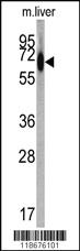 Anti-ALB Rabbit Polyclonal Antibody