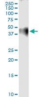 Anti-F2R Rabbit Polyclonal Antibody