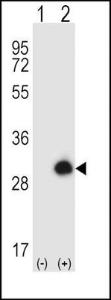 Anti-GRB2 Rabbit Polyclonal Antibody (Biotin)