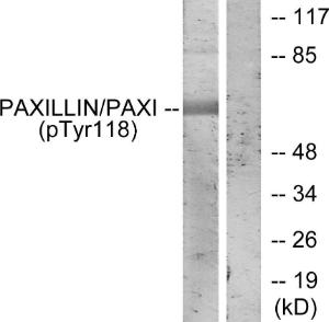 Antibody anti-paxillin phospho TYR118