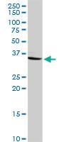 Anti-CRHBP Rabbit Polyclonal Antibody