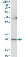 Anti-RPL21 Mouse Polyclonal Antibody