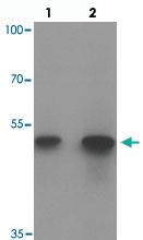 Anti-ACSL1 Rabbit Polyclonal Antibody