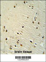 Anti-XRCC6 Rabbit Polyclonal Antibody (HRP (Horseradish Peroxidase))