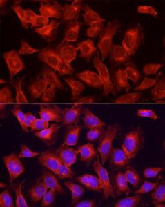 Immunofluorescence analysis of HeLa cells using Anti-ULK1 Antibody (A10448) at a dilution of 1:200 (40x lens). DAPI was used to stain the cell nuclei (blue)