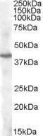 Anti-PITX3 antibody