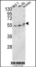 Anti-ALPL Rabbit Polyclonal Antibody