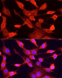 Immunofluorescence analysis of NIH/3T3 cells using Anti-ULK1 Antibody (A10448) at a dilution of 1:200 (40x lens). DAPI was used to stain the cell nuclei (blue)