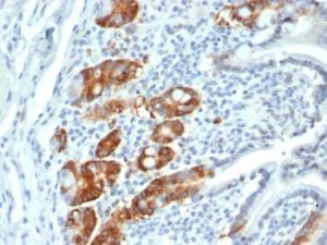 Immunohistochemical analysis of formalin-fixed, paraffin-embedded human small intestine tissue using Anti-RRM1 Antibody [RRM1/4372R]