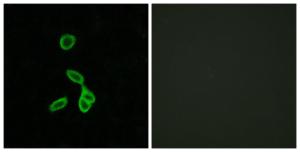 Anti-GALR1 antibody