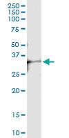 Anti-CRHBP Rabbit Polyclonal Antibody