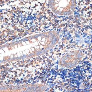 Immunohistochemistry analysis of paraffin-embedded human appendix tissue using Anti-CRMP5 Antibody [ARC2020] (A308547) at a dilution of 1:100 (40x lens)