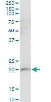 Anti-RPL21 Mouse Polyclonal Antibody