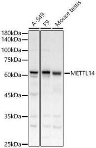 Western blot analysis of extracts of various cell lines, using Anti-METTL14 Antibody (A10449) at 1:700 dilution. The secondary antibody was Goat Anti-Rabbit IgG H&L Antibody (HRP) at 1:10,000 dilution.