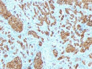 Anti-MelanA antibody