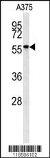 Anti-NAB2 Rabbit Polyclonal Antibody