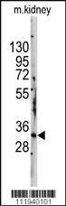 Anti-RHOJ Rabbit Polyclonal Antibody