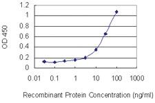 Anti-HOXB13 Mouse Monoclonal Antibody [clone: 1E9]