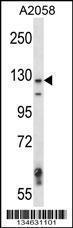 Anti-MAP3K6 Rabbit Polyclonal Antibody (HRP (Horseradish Peroxidase))