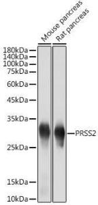 Western blot analysis of extracts of various cell lines, using Anti-PRSS2 Antibody [ARC2453] (A307566) at 1:5000 dilution