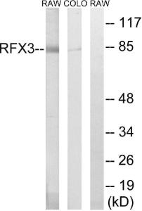 Anti-RFX3 antibody