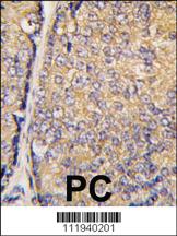 Anti-BRDG 1 (STAP1) (F56) Rabbit Polyclonal Antibody