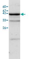 Anti-ALDH1B1 Rabbit Polyclonal Antibody