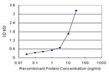 Anti-SERPINB3 Polyclonal Antibody Pair