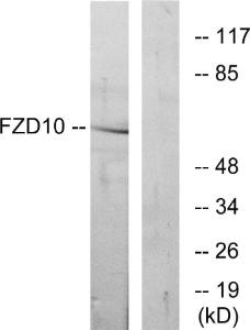 Western blot analysis of lysates from COS7 cells using Anti-FZD10 Antibody. The right hand lane represents a negative control, where the antibody is blocked by the immunising peptide