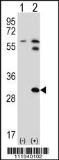 Anti-BRDG 1 (STAP1) (F56) Rabbit Polyclonal Antibody