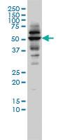 Anti-CAP2 Mouse Monoclonal Antibody [clone: 3G9-1A5]