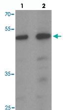 Anti-SAMSN1 Rabbit Polyclonal Antibody