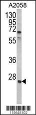 Anti-GRB2 Rabbit Polyclonal Antibody