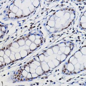 Immunohistochemistry analysis of paraffin-embedded human colon tissue using Anti-METTL14 Antibody (A10449) at a dilution of 1:100 (40x lens). Perform high pressure antigen retrieval with 10 mM citrate buffer pH 6.0 before commencing with IHC staining protocol.