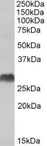 Antibody anti-HLA-DQA2 100 µg