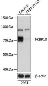 Anti-FKBP10 antibody