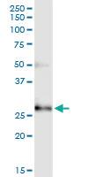 Anti-CCBE1 Polyclonal Antibody Pair