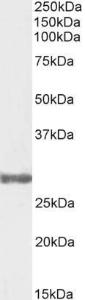 Anti-COMT Antibody (A82512) (03 µg/ml) staining of Human Testis lysate (35 µg protein in RIPA buffer) Primary incubation was 1 hour Detected by chemiluminescence