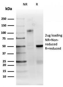 SDS-PAGE analysis of Anti-RRM1 Antibody [RRM1/4372R] under non-reduced and reduced conditions; showing intact IgG and intact heavy and light chains, respectively SDS-PAGE analysis confirms the integrity and purity of the antibody