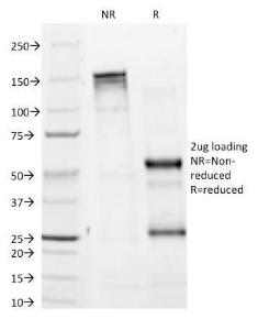 SDS-PAGE analysis of Anti-Tyrosinase Antibody [T311] under non-reduced and reduced conditions; showing intact IgG and intact heavy and light chains, respectively SDS-PAGE analysis confirms the integrity and purity of the antibody