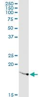 Anti-RPL23A Mouse Monoclonal Antibody [clone: 3E11]