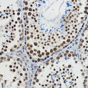 Immunohistochemistry analysis of paraffin-embedded mouse testis using Anti-METTL14 Antibody (A10449) at a dilution of 1:100 (40x lens). Perform high pressure antigen retrieval with 10 mM citrate buffer pH 6.0 before commencing with IHC staining protocol.