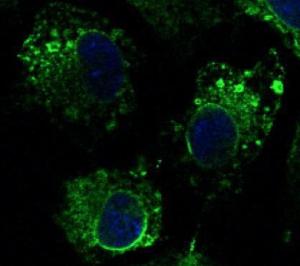 Hepa 1-6 cells, fixed with 4% PFA, stained with Anti-Calnexin Antibody at a 1:100 dilution