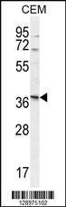 Anti-NXPH4 Rabbit Polyclonal Antibody (PE (Phycoerythrin))