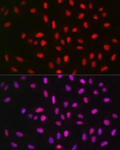 Immunofluorescence analysis of U2OS cells using Anti-METTL14 Antibody (A10449) at a dilution of 1:50 (40x lens). DAPI was used to stain the cell nuclei (blue).